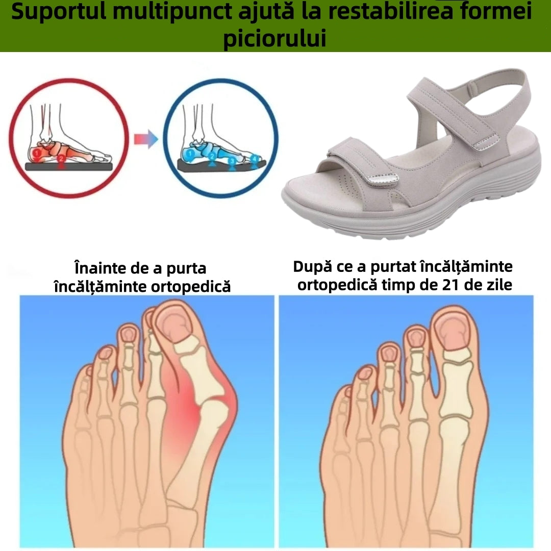 ⏰Ultima zi cu reducere de 70% - Nu rata ocazia!✅️Sandale confortabile cu suport pentru bolta plantară - Design ergonomic