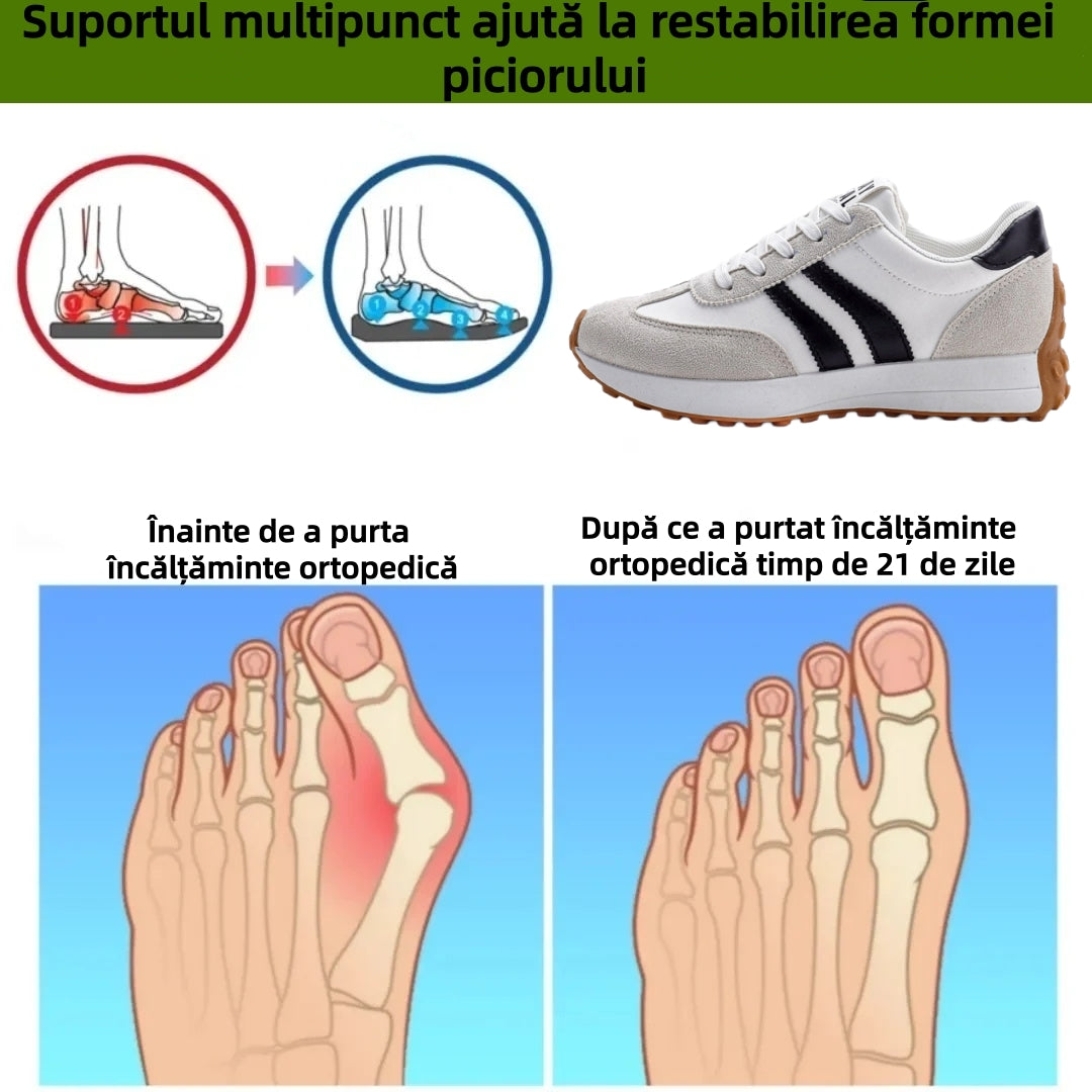 ⏰Ultima zi! Reducere 70% - Nu rata ocazia! ✅️Încălțăminte confortabilă pentru femei cu suport pentru bolta plantară - design ergonomic