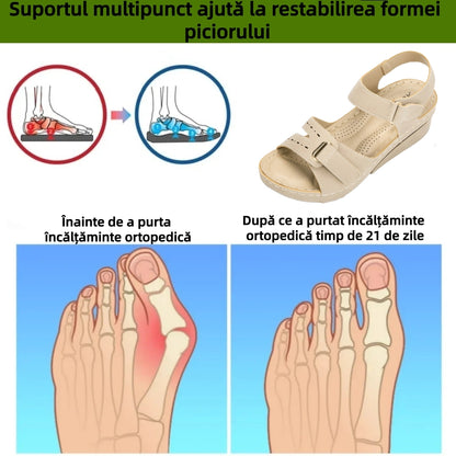 ⏰Ultima zi cu reducere de 70% - Nu rata ocazia!✅️Sandale confortabile cu suport pentru bolta plantară - Design ergonomic