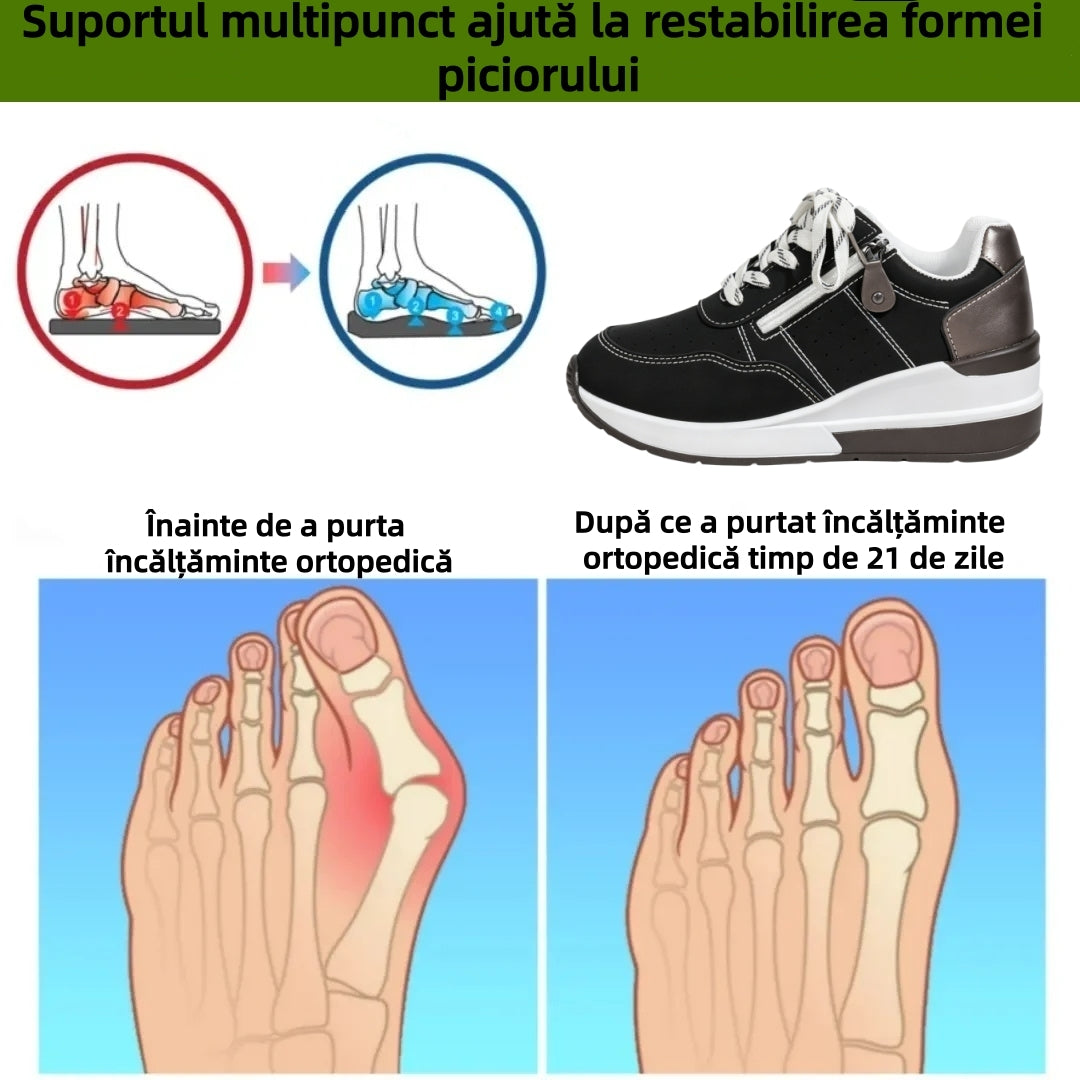 ⏰Ultima zi! Reducere 70% - Nu rata ocazia! ✅️Încălțăminte confortabilă pentru femei cu suport pentru bolta plantară - design ergonomic